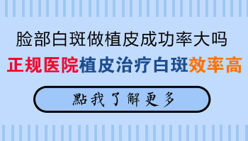 脸部白斑做植皮成功几率大吗.jpg