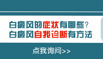 白癜风的症状你知道吗