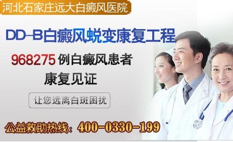 专家推荐：治疗白癜风用什么方法好?