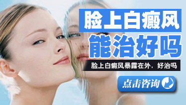 治疗女性白癜风什么方法好