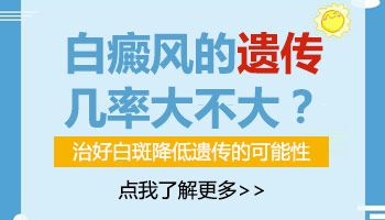 白癜风患者是否能结婚生孩子呢