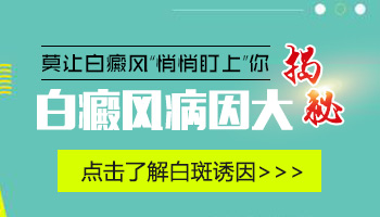 盘点白癜风的易感人群