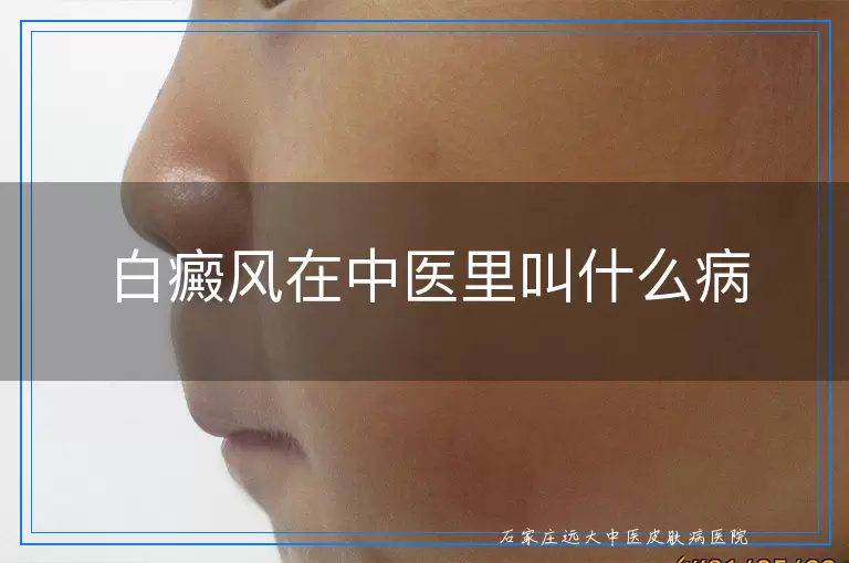 白癜风在中医里叫什么病