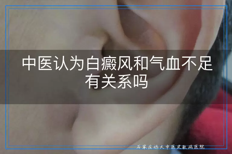 中医认为白癜风和气血不足有关系吗