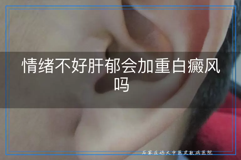 情绪不好肝郁会加重白癜风吗
