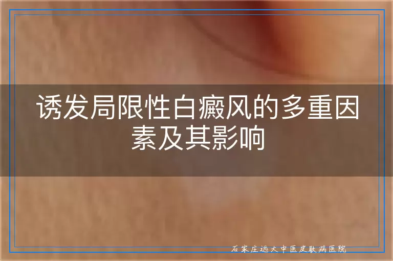 诱发局限性白癜风的多重因素及其影响
