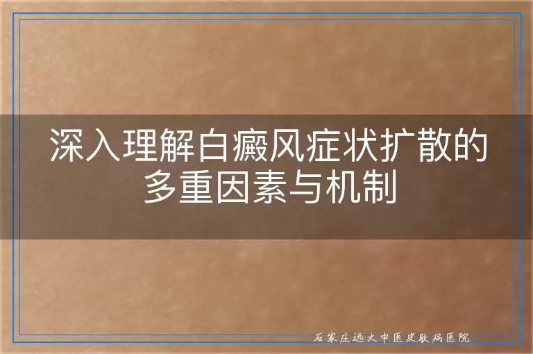 深入理解白癜风症状扩散的多重因素与机制