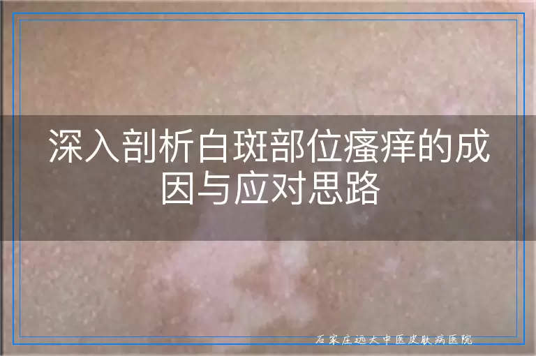 深入剖析白斑部位瘙痒的成因与应对思路