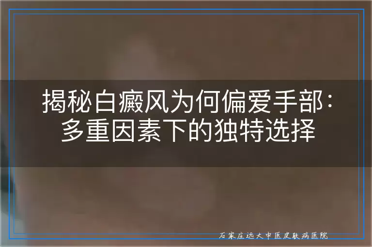 揭秘白癜风为何偏爱手部：多重因素下的独特选择