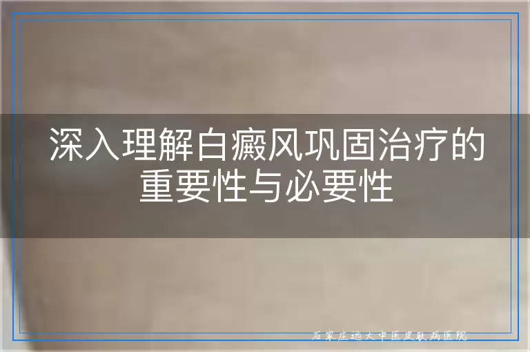 深入理解白癜风巩固治疗的重要性与必要性