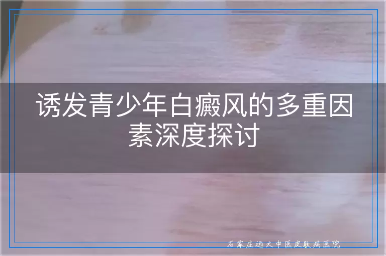 诱发青少年白癜风的多重因素深度探讨