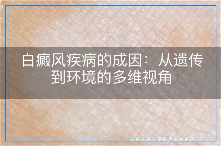 白癜风疾病的成因：从遗传到环境的多维视角