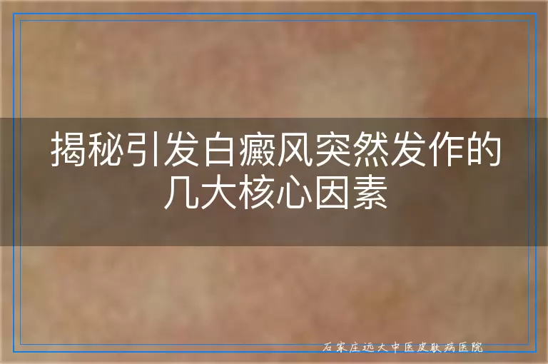 揭秘引发白癜风突然发作的几大核心因素