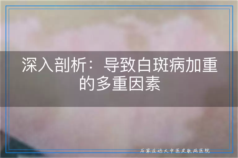 深入剖析：导致白斑病加重的多重因素