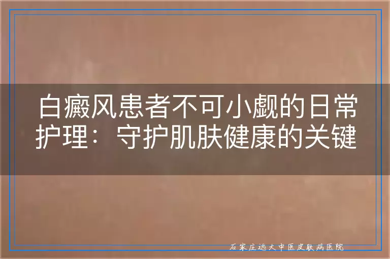 白癜风患者不可小觑的日常护理：守护肌肤健康的关键之道