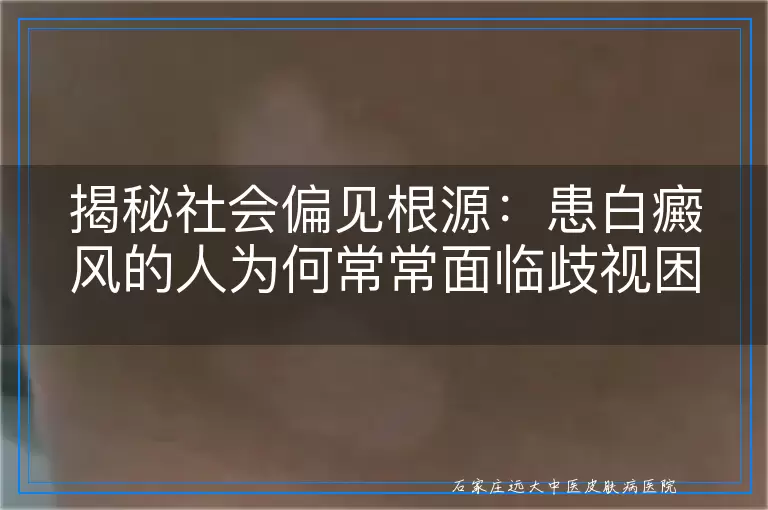 揭秘社会偏见根源：患白癜风的人为何常常面临歧视困境