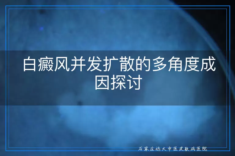 白癜风并发扩散的多角度成因探讨