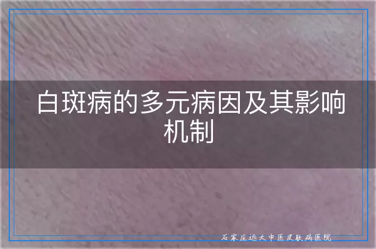 白斑病的多元病因及其影响机制