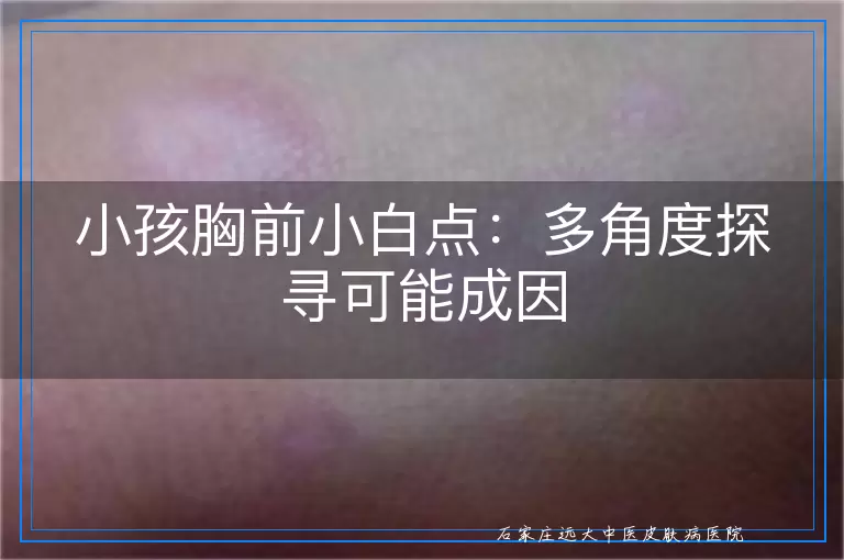 小孩胸前小白点：多角度探寻可能成因