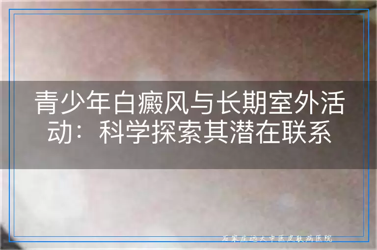 青少年白癜风与长期室外活动：科学探索其潜在联系