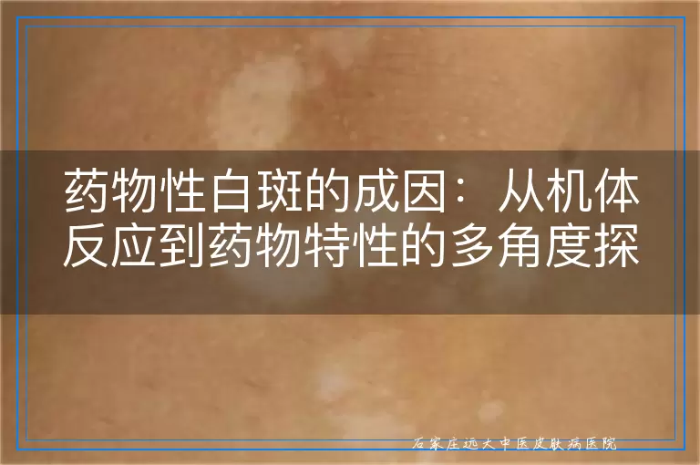 药物性白斑的成因：从机体反应到药物特性的多角度探讨