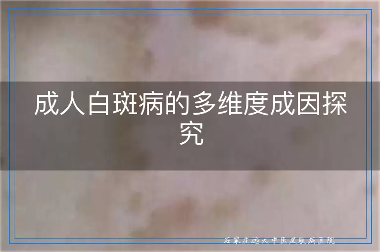 成人白斑病的多维度成因探究