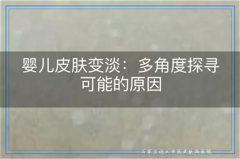 婴儿皮肤变淡：多角度探寻可能的原因