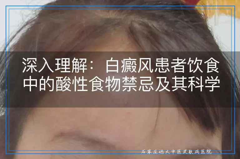 深入理解：白癜风患者饮食中的酸性食物禁忌及其科学依据