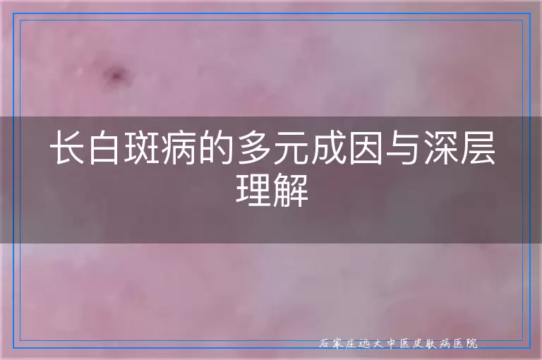 长白斑病的多元成因与深层理解