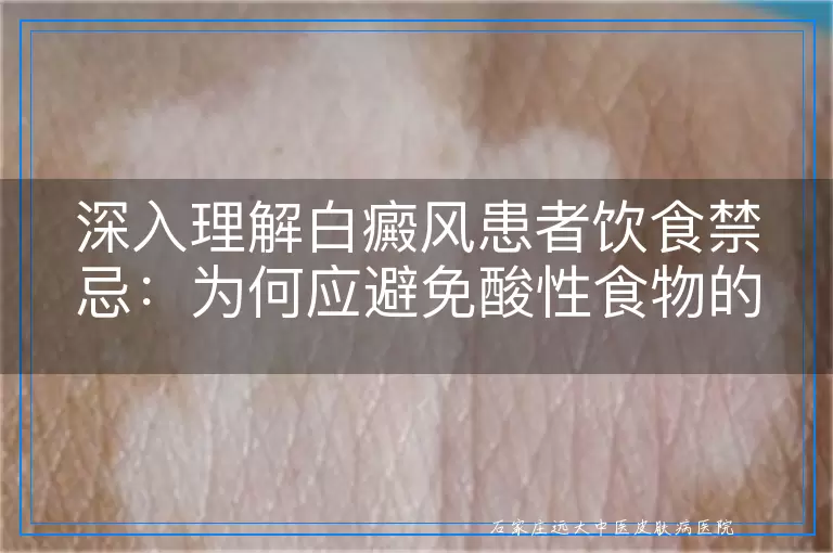 深入理解白癜风患者饮食禁忌：为何应避免酸性食物的摄入