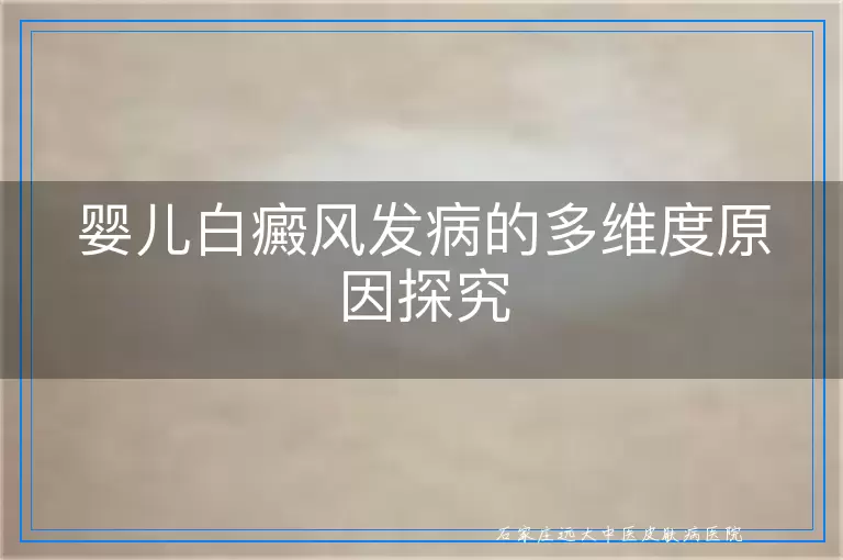 婴儿白癜风发病的多维度原因探究