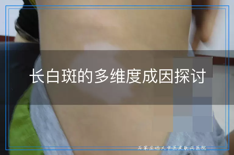 长白斑的多维度成因探讨