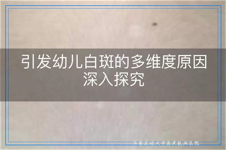 引发幼儿白斑的多维度原因深入探究
