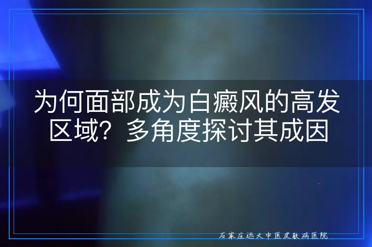 为何面部成为白癜风的高发区域？多角度探讨其成因