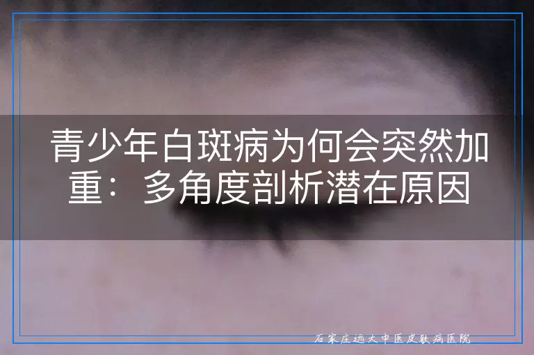 青少年白斑病为何会突然加重：多角度剖析潜在原因