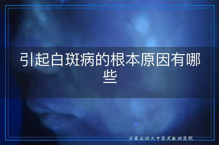 引起白斑病的根本原因有哪些
