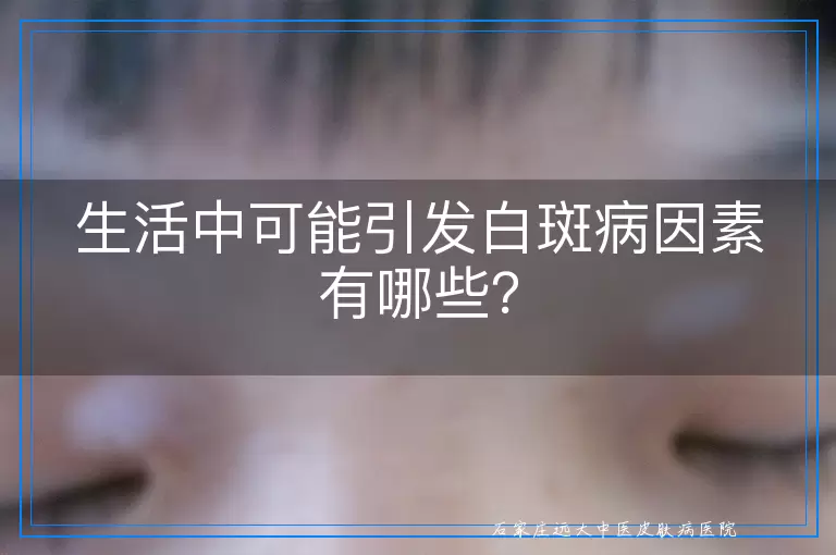 生活中可能引发白斑病因素有哪些？