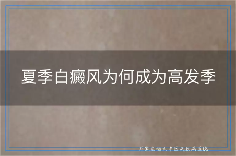 夏季白癜风为何成为高发季
