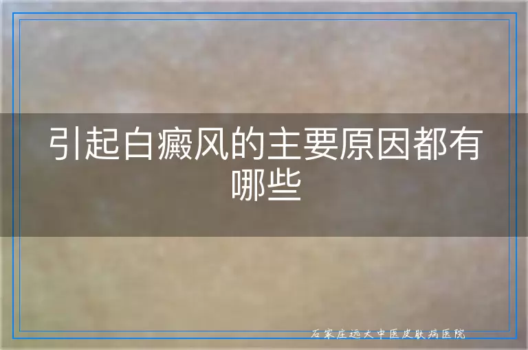 引起白癜风的主要原因都有哪些
