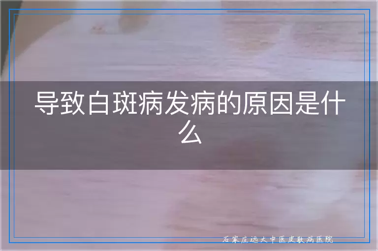 导致白斑病发病的原因是什么