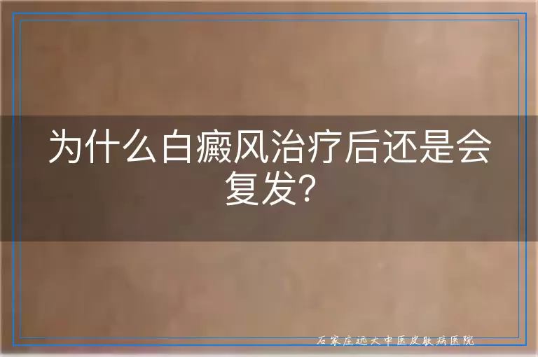 为什么白癜风治疗后还是会复发？