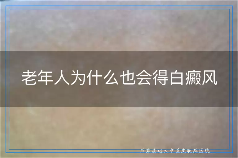 老年人为什么也会得白癜风