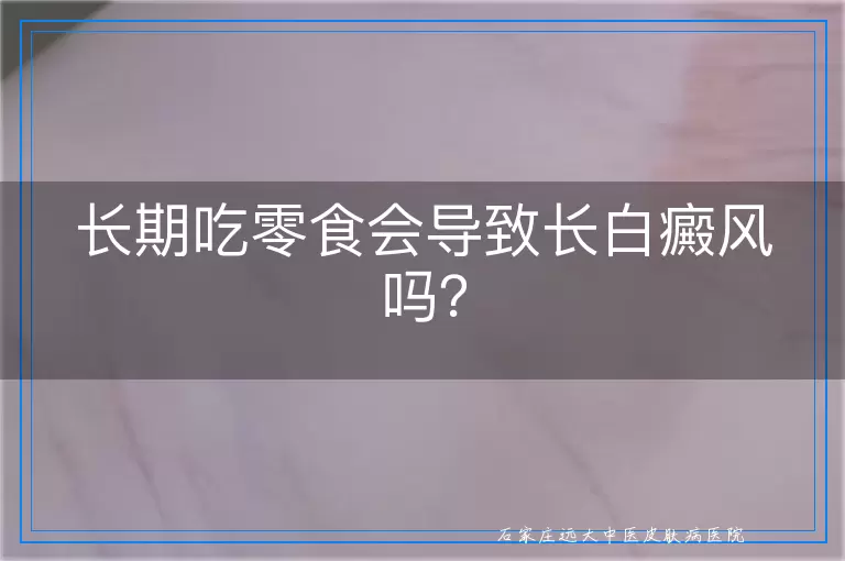 长期吃零食会导致长白癜风吗？