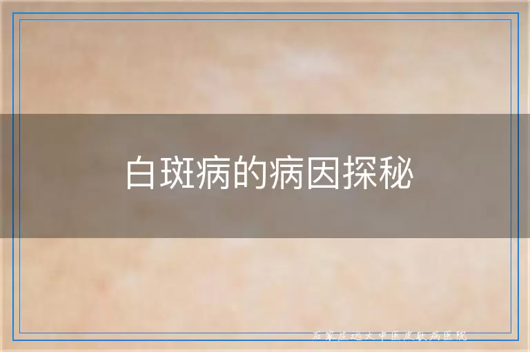 白斑病的病因探秘