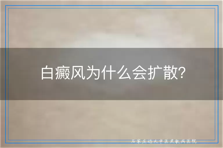 白癜风为什么会扩散？