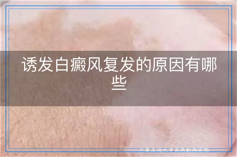 诱发白癜风复发的原因有哪些