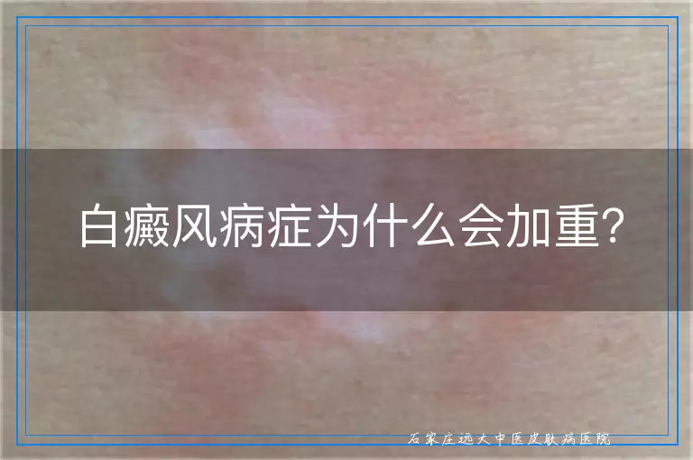 白癜风病症为什么会加重？