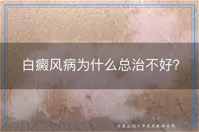 白癜风病为什么总治不好？