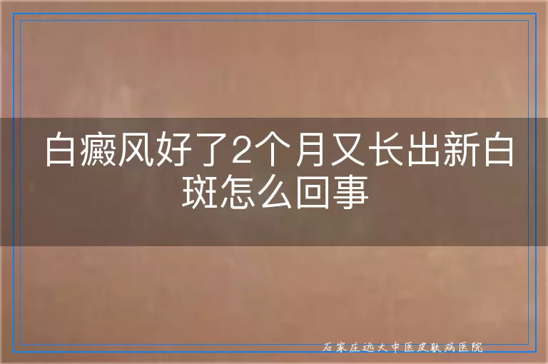 白癜风好了2个月又长出新白斑怎么回事