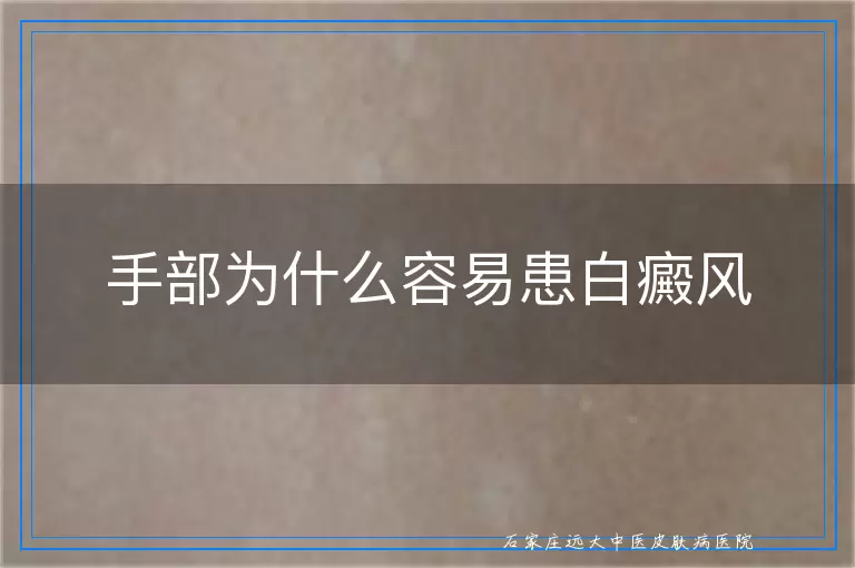 手部为什么容易患白癜风